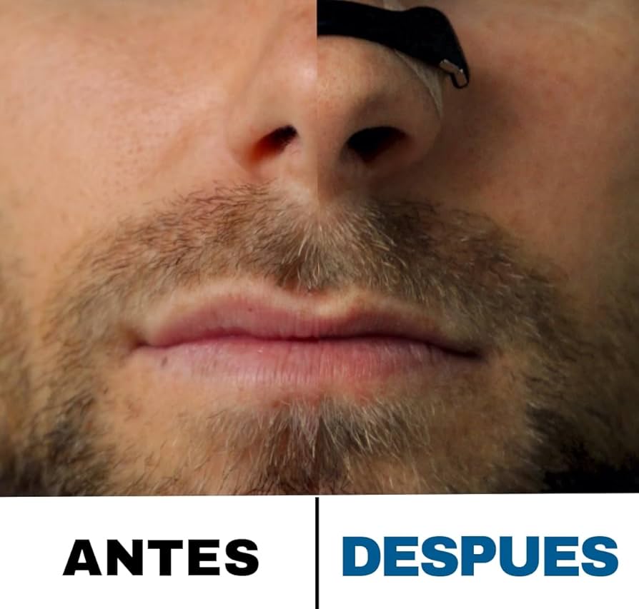 RESPIRACLIPS® /  CLIPS NASALES