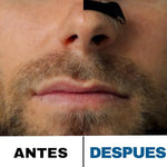 RESPIRACLIPS® /  CLIPS NASALES