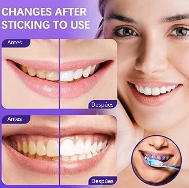 Sonríe+/Blanqueador Dental Morado: Corrige el amarillo, revela tu blanco natural.